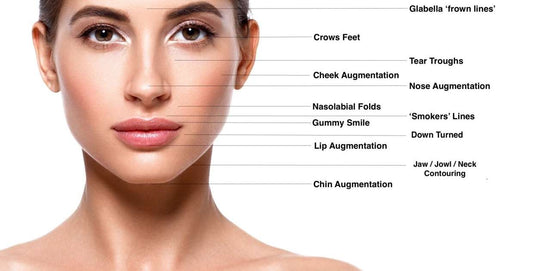 What are the common uses for cosmetic fillers?